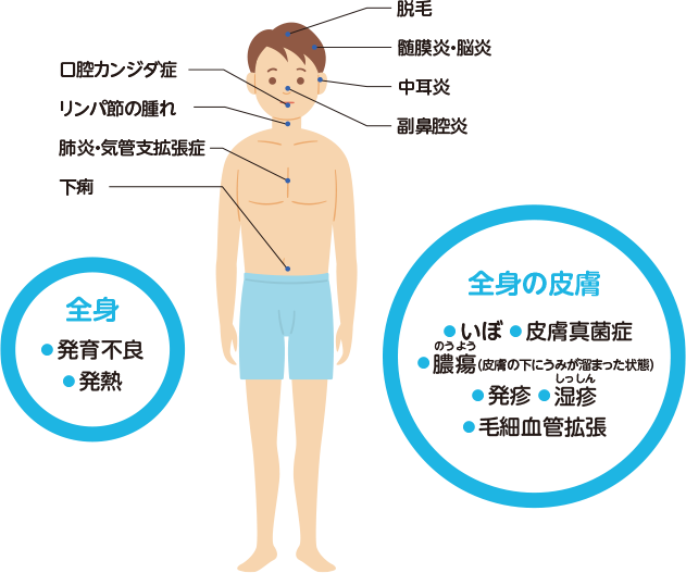 画像:全身・発育不良・発熱 全身の皮膚・いぼ・皮膚真菌症・膿瘍・発疹・湿疹・毛細血管拡張